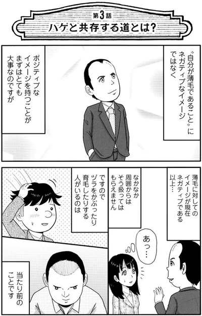 【全画像を見る】僕は髪の毛が少ない