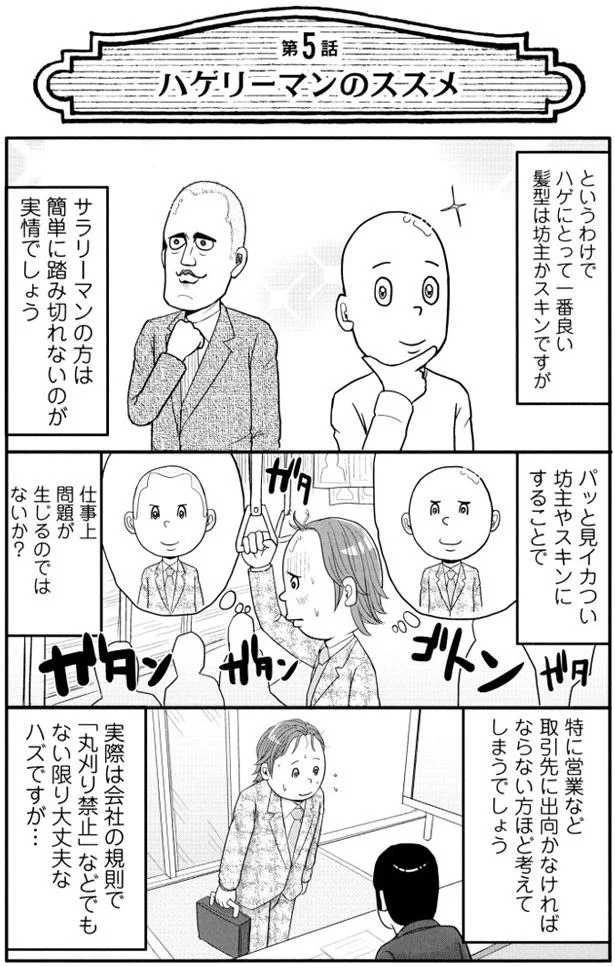 【全画像を見る】僕は髪の毛が少ない