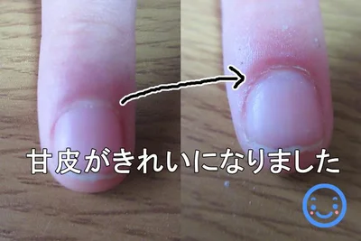【画像】「電動ネイルケアセット」で甘皮がツルツルに♪