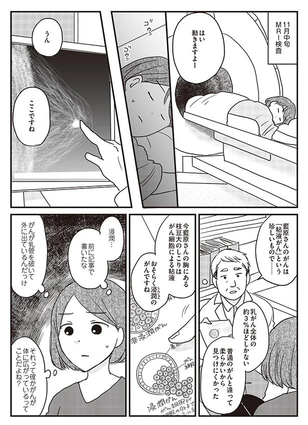 【画像を見る】がんの記事を書いてきた私が乳がんに!? 育児があるのにがんもきた