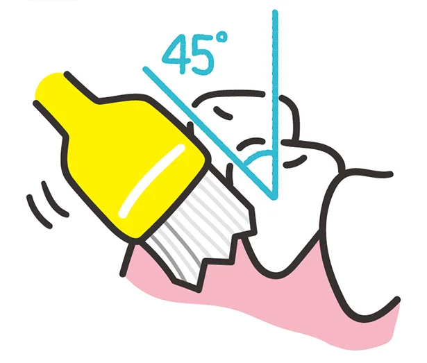 歯ブラシのコツは、歯こうがつきやすい歯と歯ぐきの間に歯ブラシを斜め45度にあてて磨くこと。