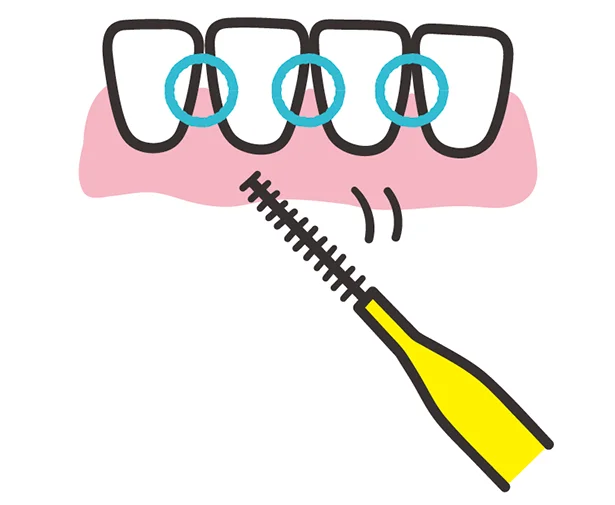 歯間に歯間ブラシを差し込み、前後に1～2回動かす。
