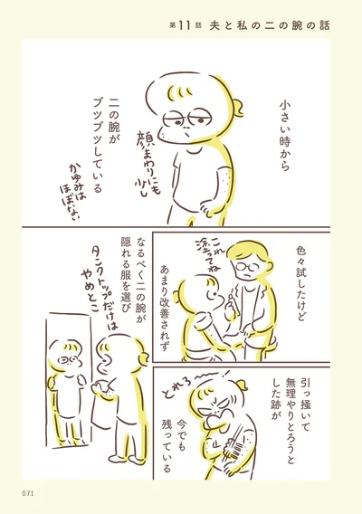 【画像を見る】夫と私の二の腕の話