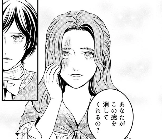 あなたがこの痣を消してくれるの?