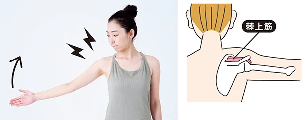 肩甲骨から腕のつけ根にかけてついている棘上筋は腕を上げるときに使います。棘上筋(きょくじょうきん)のファシアの余分な水分を、押し流しましょう。