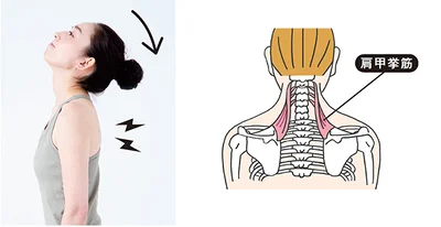首の骨の左右に走る筋肉で、肩甲骨を引き上げるのが役目。かたくなると頭を後ろに倒しにくくなります。