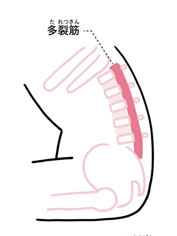 腰がストレート化すると椎つい間かん板ばんにも負担が