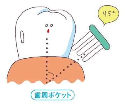歯周ポケットの掃除には、ブラシを歯と歯ぐきの境に45度の角度で当てましょう。