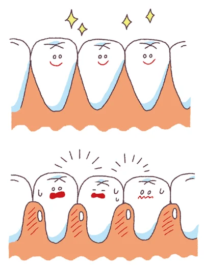 歯ぐきを傷つけていないか確認を。歯と歯の間の歯ぐきが丸みを帯びていたら、傷がついて炎症を起こしている可能性が。