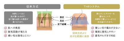 18年間の開発実績が生んだ独自光美容技術「THRシステム」