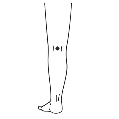 「委中」（いちゅう）▷腰や背中の痛み、脚のだるさ、頭痛などに効果を発揮する、ひざ裏にあるツボ。