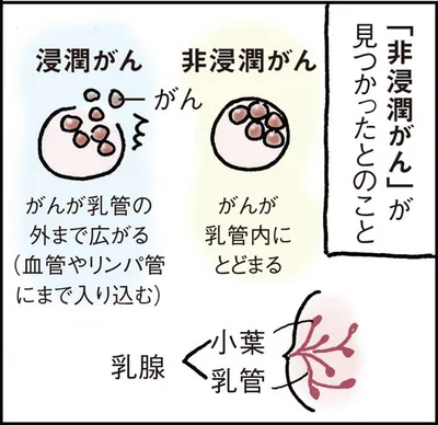 「非浸潤がん」が見つかったとのこと