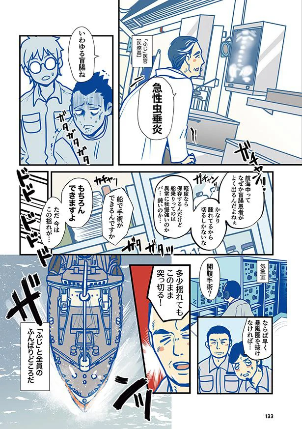 急性虫垂炎