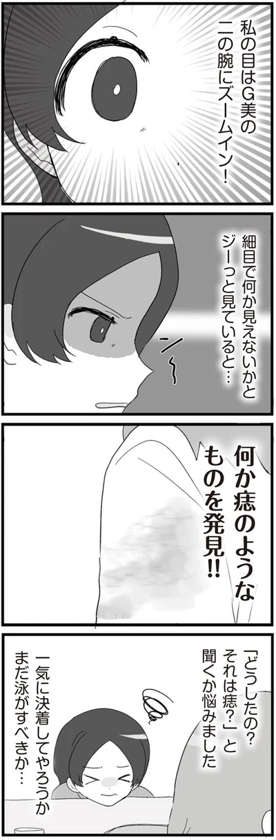 痣のようなものを発見！！