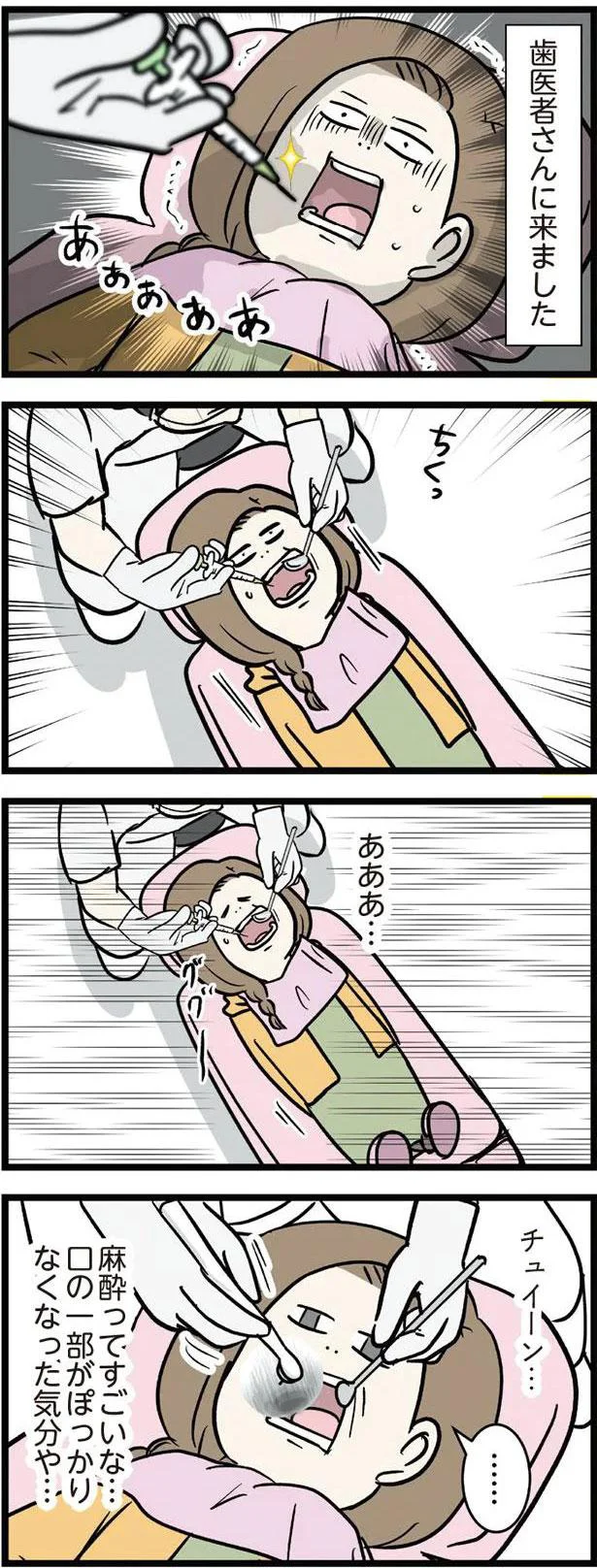 麻酔ってすごいな…