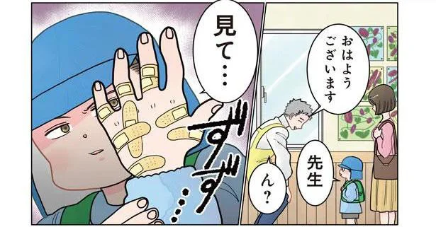 「お母さんこれは!?」男の子の手が絆創膏だらけの理由が面白すぎる／保育士でこ先生3（2）