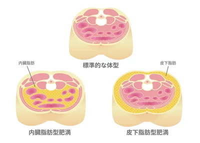 「トリプルリスク」の元凶となる内臓脂肪