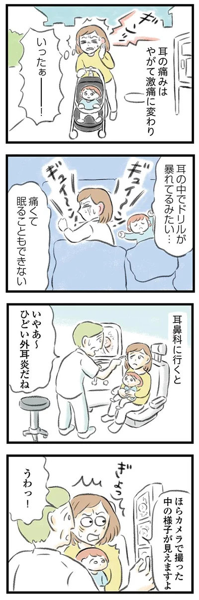 耳鼻科に行くと