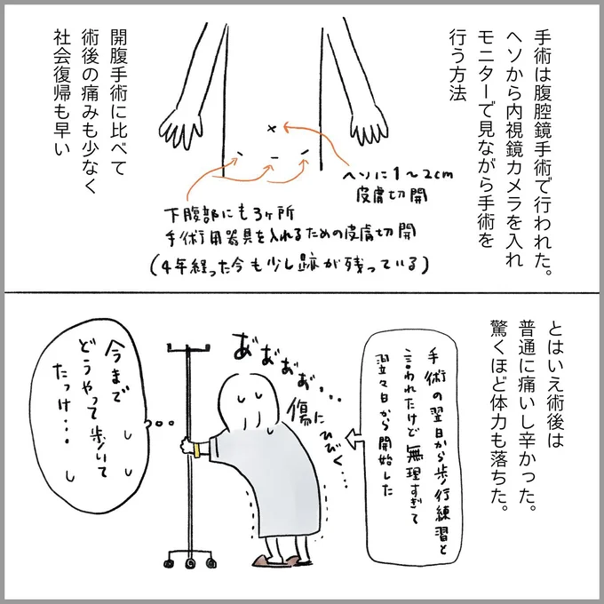 生理痛・卵巣のう腫破裂がしんどすぎて出産が○○だった話 卵巣破裂編 第11話 02