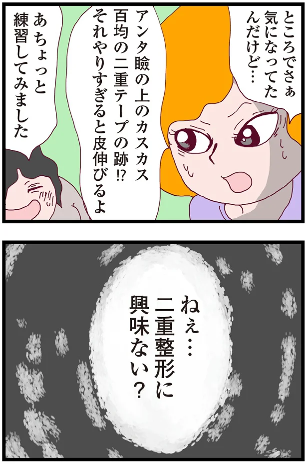 二重整形に興味ない？