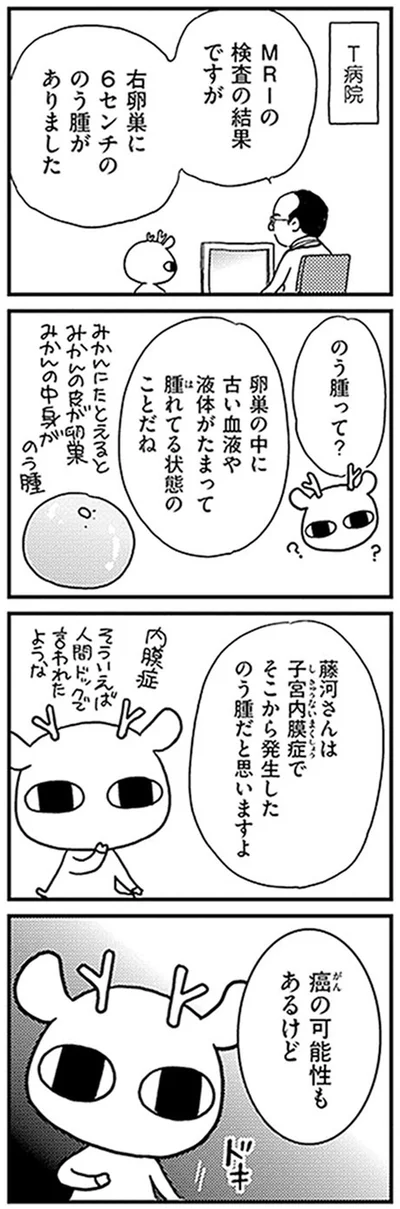 右卵巣に6センチののう腫がありました