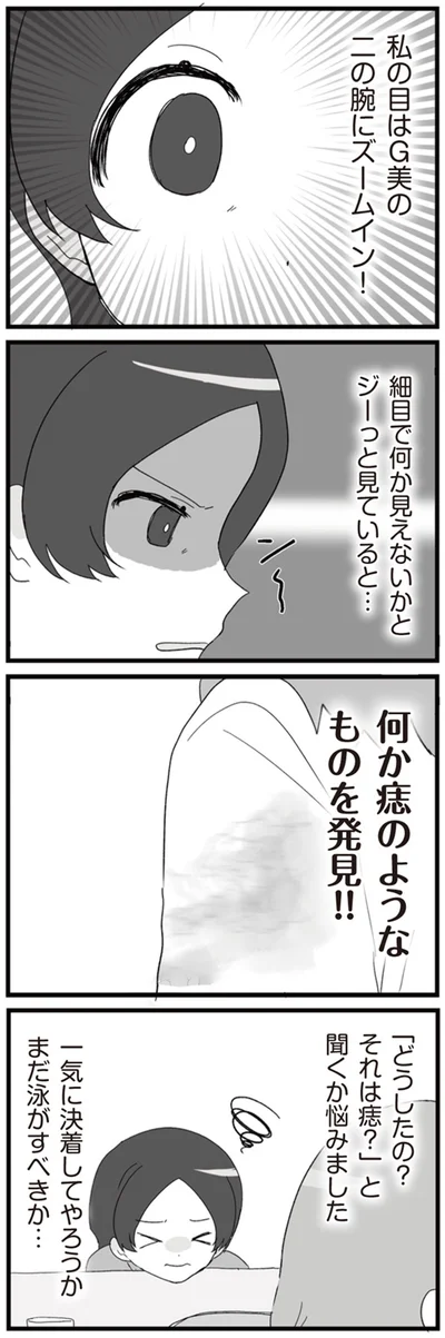 何か痣のようなもを発見！！