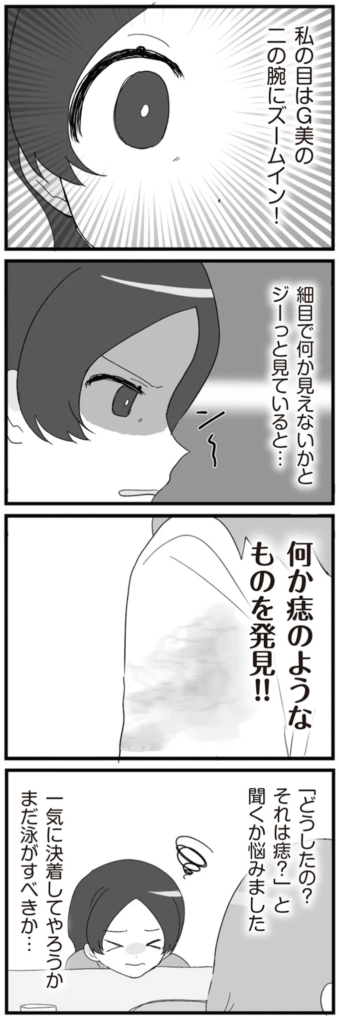何か痣のようなもを発見！！