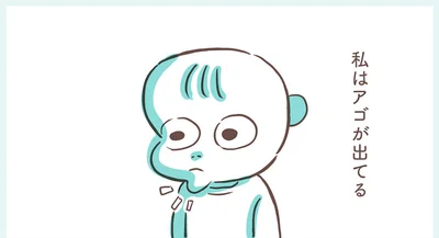 私はアゴが出ている