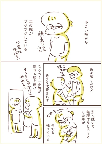 小さい時から二の腕がブツブツしている