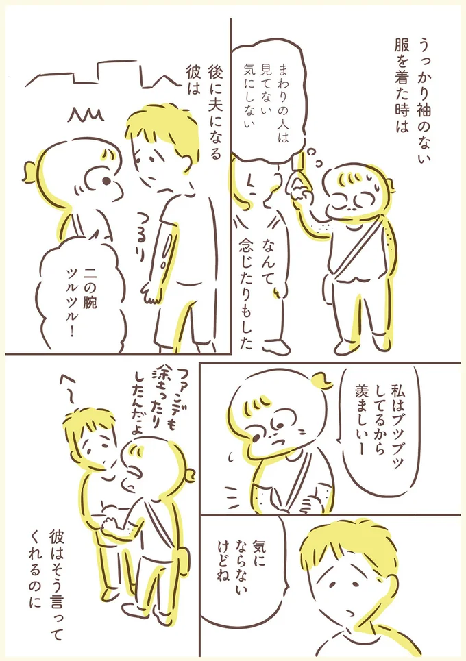 私はブツブツしてるから羨ましいー