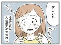 うつ病の夫を支える妻の体に変化が？ 猛烈なかゆみに肌荒れ、どうなってるの!?／夫婦で心を病みました（6）