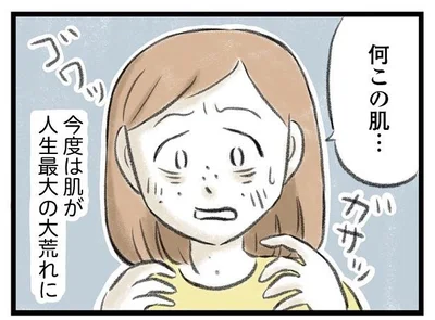 肌が人生最大の大荒れに