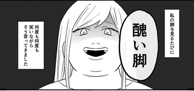 醜い脚