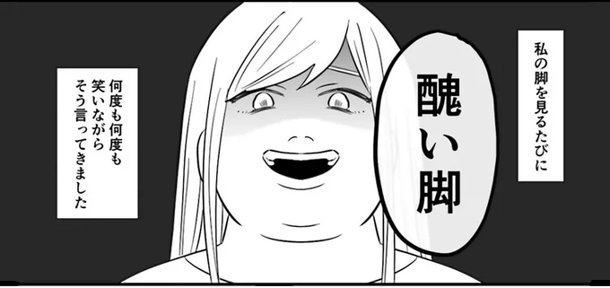 醜い脚