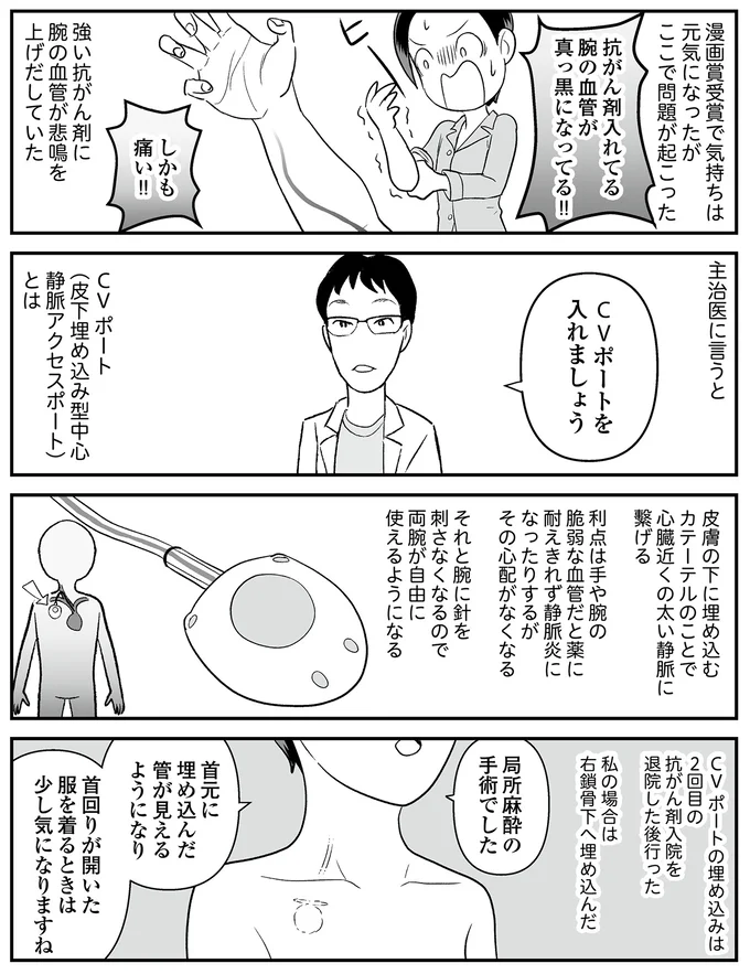 腕の血管が真っ黒