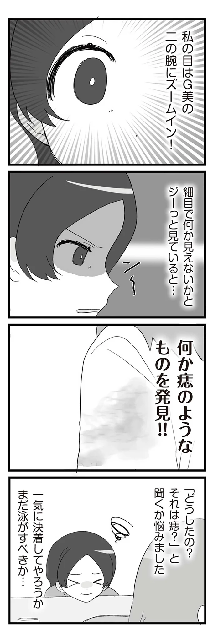 何か痣のようなものを発見！！