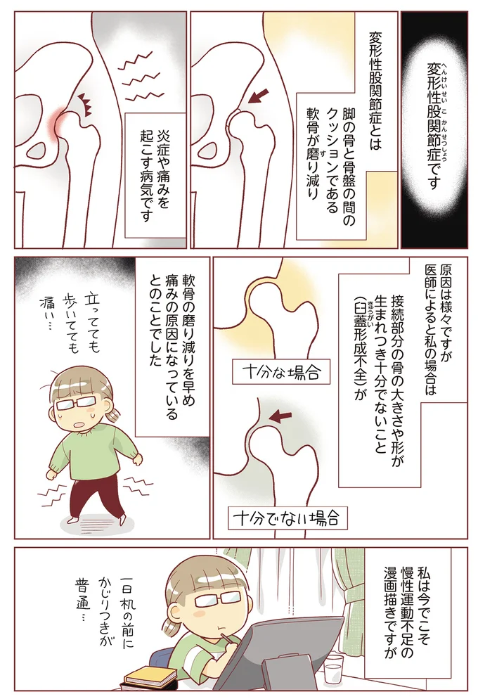 変形性股関節症