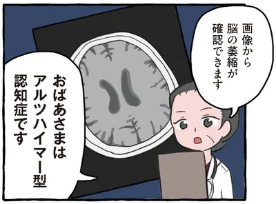 おばあさまはアルツハイマー型認知症です