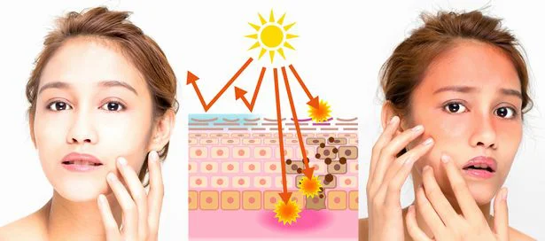 あなたは大丈夫？ 秋にも影響が出る、夏の紫外線ダメージ「あるある」をチェック！