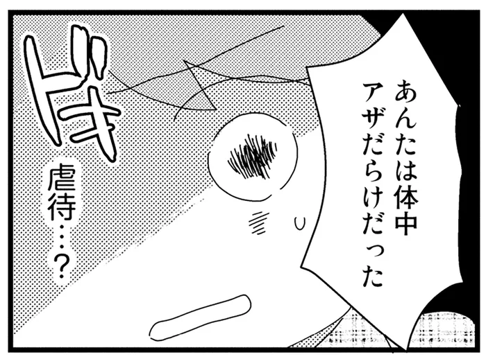 「あんたは体中アザだらけだった」中学生になって知った母不在の真相／母親に捨てられて残された子どもの話（10）