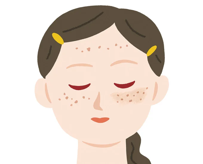  UVケアだけでは不充分だった！「シミ予防対策」しっかりできてますか？