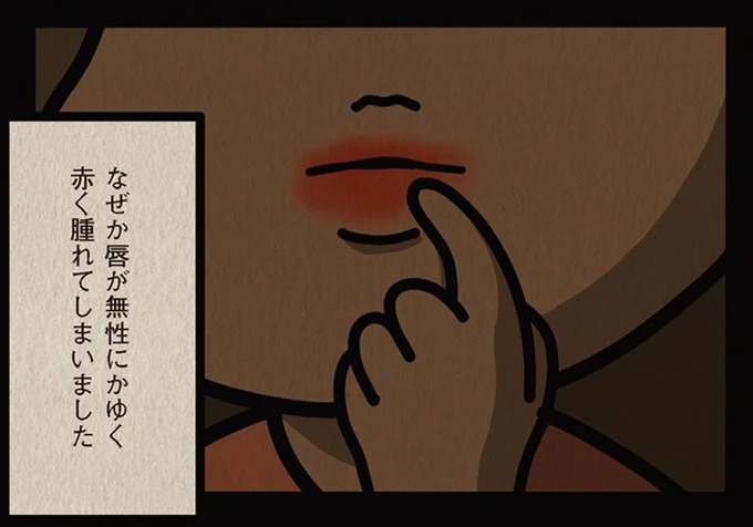 出会ったばかりの男性とキスしたら唇が腫れた！ まさかの原因に絶句