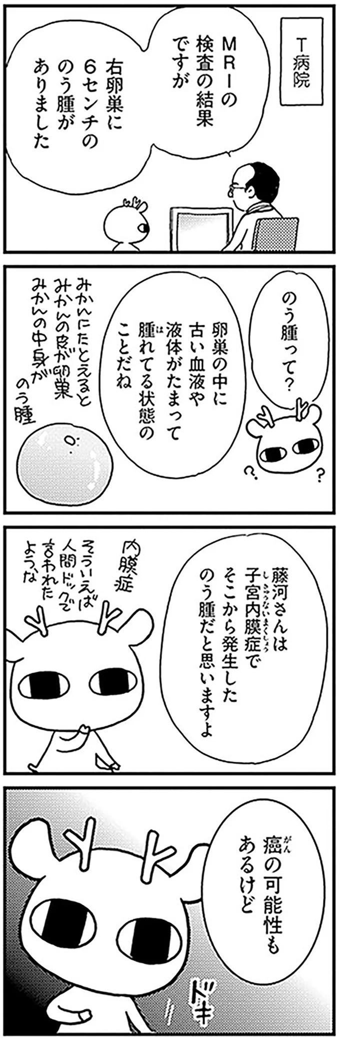 右卵巣に6センチののう腫がありました