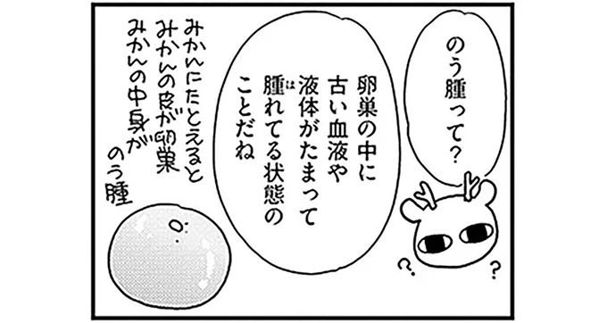 のう腫って?