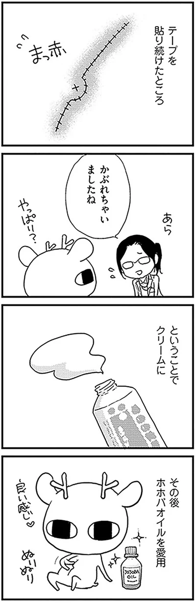 かぶれちゃいましたね