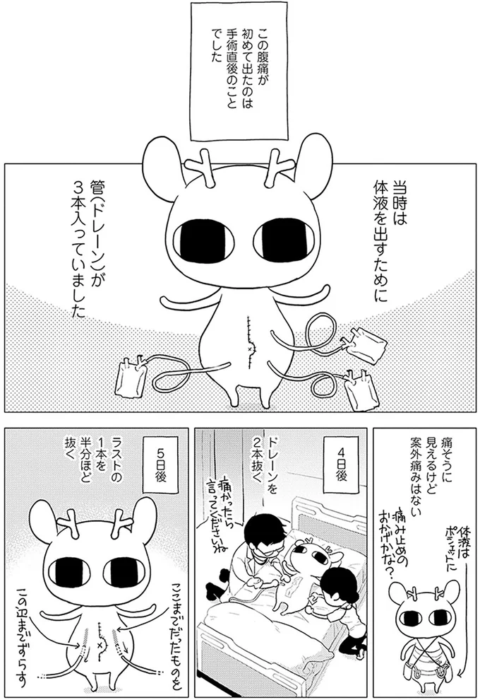 体液を出すために管（ドレーン）が3本入っていました
