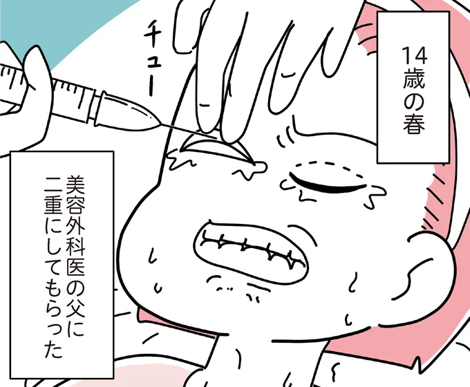 美容外科医の父に二重にしてもらった