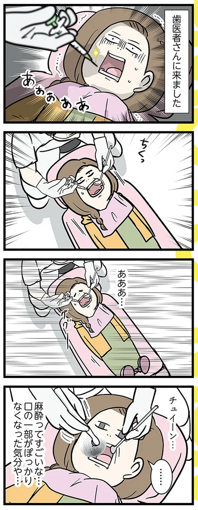 麻酔ってすごいな…
