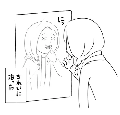 きれいに治った