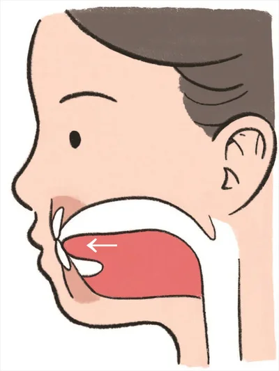 舌が上あごについていない「落ち舌」の状態